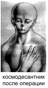 Типичный вид космодесантника после операции