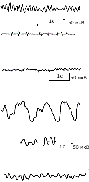 Основные ритмы и параметры энцефалограммы. рисунок