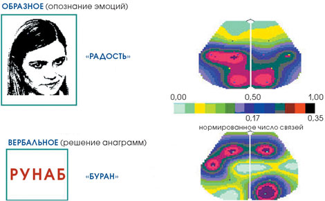 На картах мозга цветом обозначены области коры, в зависимости от нормированного числа подходящих к ним связей. При образном мышлении фокусы расположены в теменно-височной, а при вербальном - в лобной коре. Центр восприятия речи в левой височной коре (зона Вернике) задействован в обоих случаях