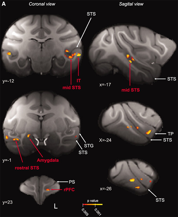 Участки мозга макак-резусов, объем серого вещества в которых увеличивается у особей, живущих в больших коллективах (выделены желтым и красным). Слева — фронтальные (поперечные) срезы мозга, справа — сагиттальные (продольные). Изображение из обсуждаемой статьи в Science