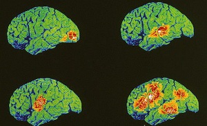 Зоны мозга, ответственные за зрение, слух, речь и «думание» (фото <noindex><a target=_blank href=http://sciencephoto.com>Wellcome Dept. Of Cognitive Neurology</a></noindex>).