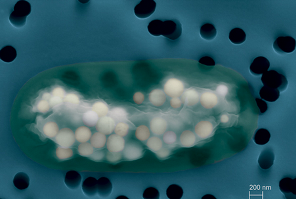 Цианобактерия с карбонатными гранулами внутри (фото авторов исследования).