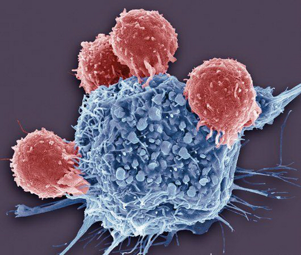 Т-лимфоциты обнаружили раковую клетку. (Фото <noindex><a target=_blank href=http://www.sciencephoto.com>Steve Gschmeissner</a></noindex>.)