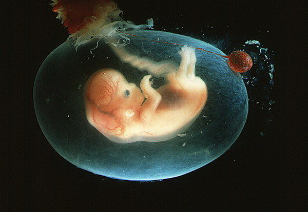 Семинедельный зародыш человека в амниотическом мешке, прикреплённый пуповиной к плаценте (фото <noindex><a target=_blank href=http://www.sciencephoto.com>Dr G. Moscoso</a></noindex>).