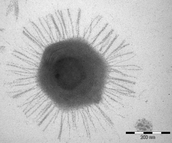 Потрет одного из крупнейших современных вирусов — мимивируса (фото <noindex><a target=_blank href=http://www.flickr.com/photos/vanou></a>vanou</a></noindex>).
