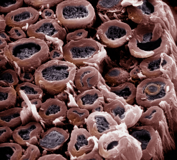 Нервные волокна, изолированные друг от друга миелиновыми оболочками (фото <noindex><a target=_blank href=http://www.corbisimages.com>Dr. Richard Kessel & Dr. Randy Kardon / Tissues & Organs</a></noindex>).