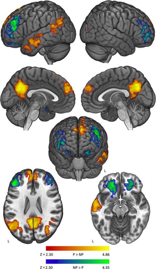 Активность в разных участках мозга при обработке контраргументов политических (выделены красным и жёлтым) и неполитических (выделены голубым и зелёным) убеждений.