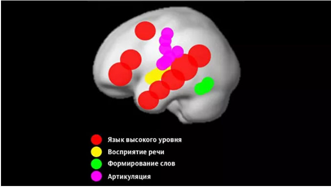 Области мозга, отвечающие за формирование различных аспектов языка